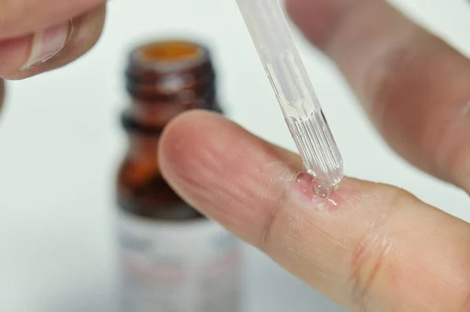 Cómo eliminar verrugas de las manos