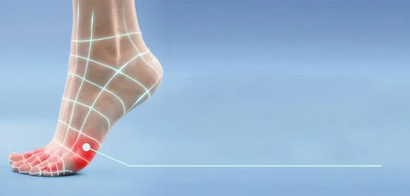 Cómo quitar los callos de los pies