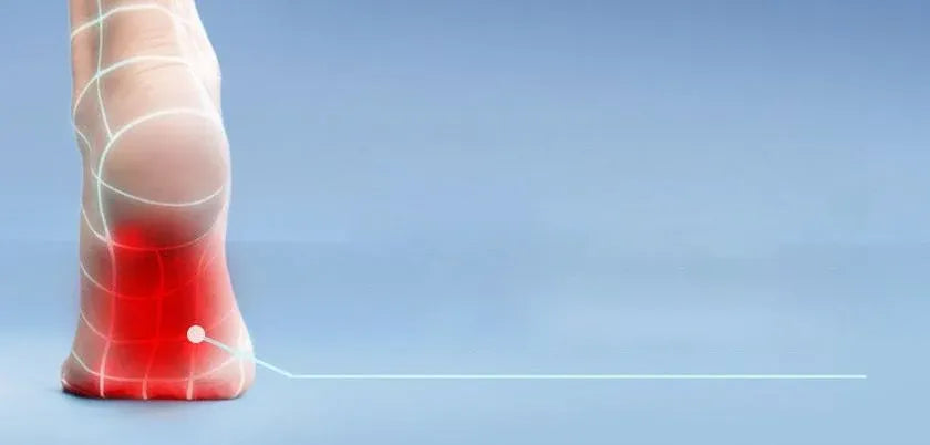 Cómo tratar la fascitis plantar