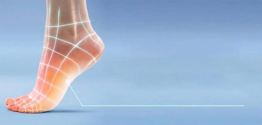 Verruga plantar: síntomas y tratamiento